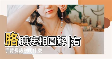 手臂長痣|痣是什麼？會變成黑色素瘤？7種一定要除的痣